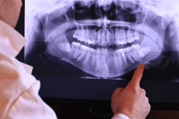 Best Emergency Dental Care for Broken or Chipped Teeth in Irwindale, CA